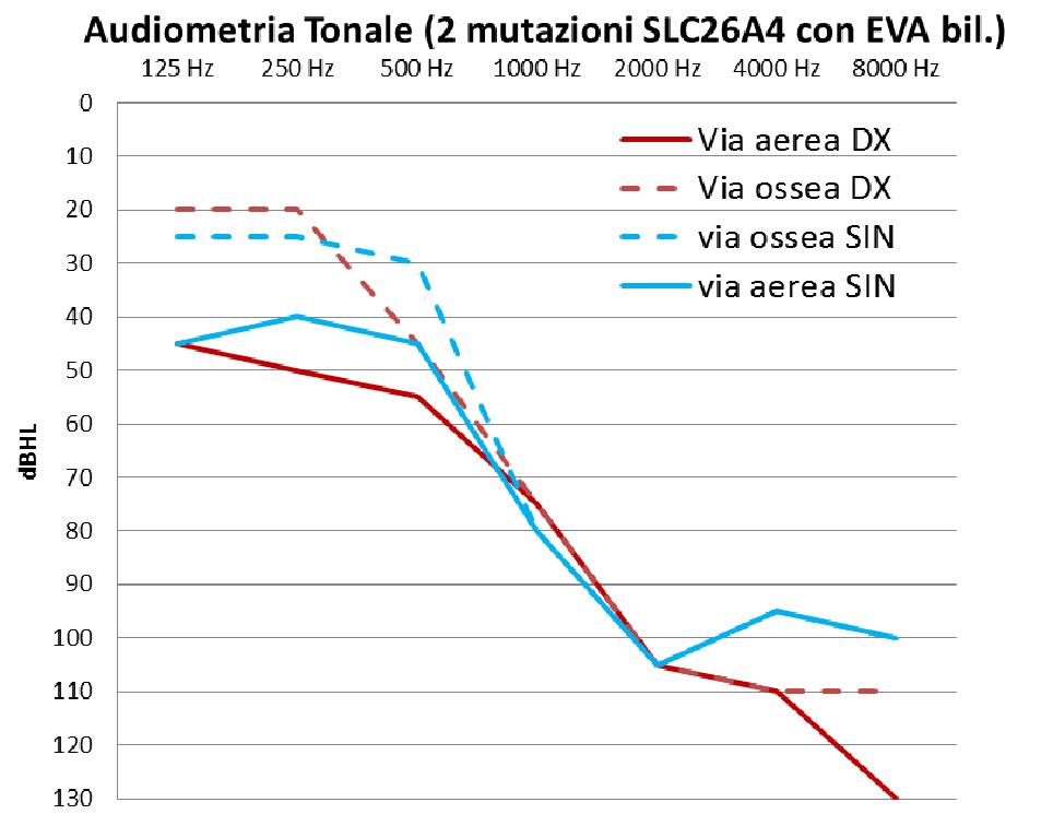 Audiometria tonale